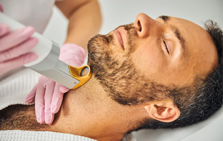 best laser hair removal mens health near me